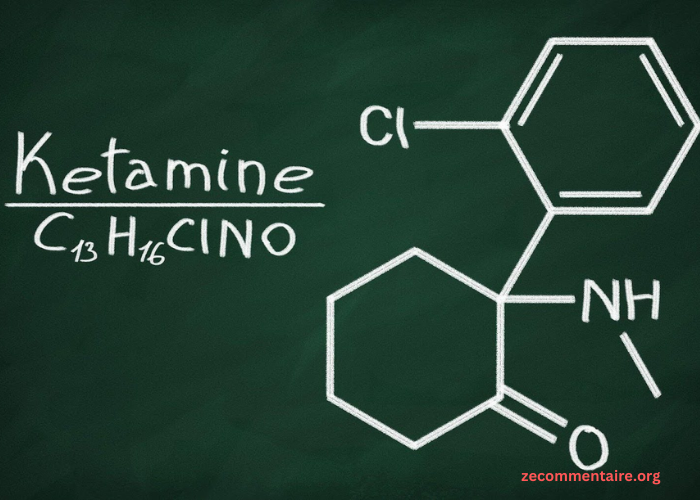 Understanding the Various Factors that Affect Ketamine Therapy Costs