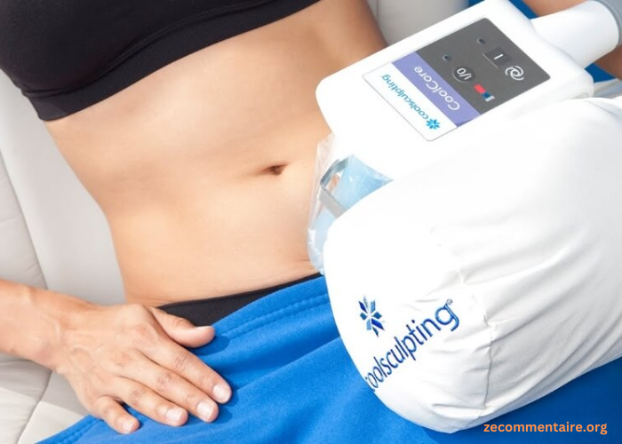 Coolsculpting Cost: Understanding Pricing Factors And Budgeting For Your Fat Reduction Journey