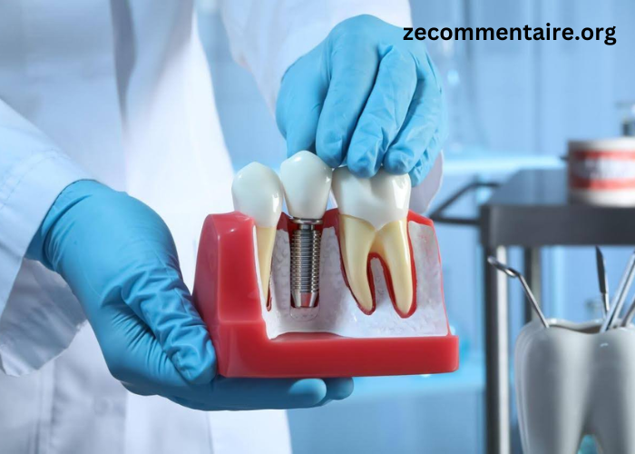 Dental Bridges vs Implants: Which Option is Right for You?