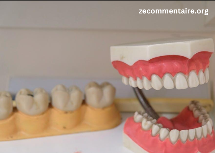 The Ultimate Guide to Full Dentures: 9 Things You Need to Know